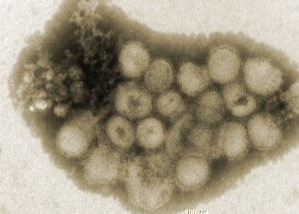sao-paulo-virus
